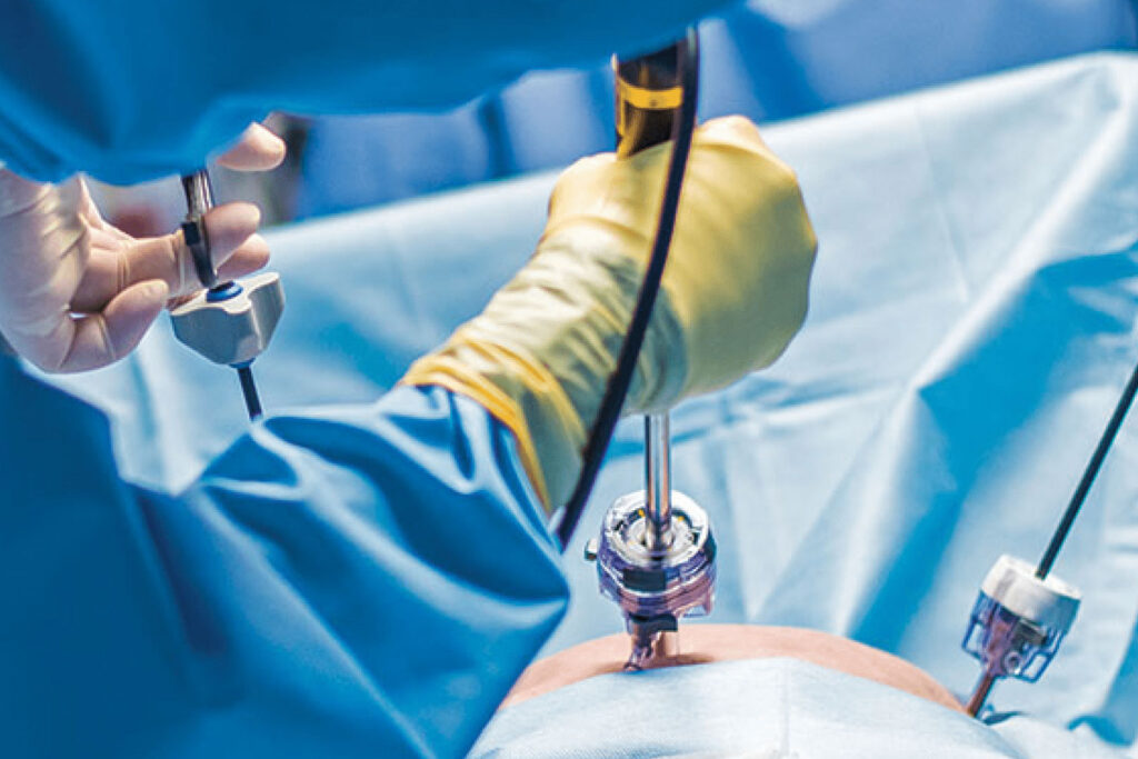 Surgical technology - medical professionals in operating room