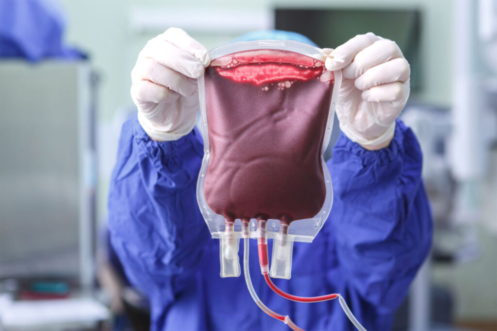 Bioprocessing - healthcare professional with blood bag